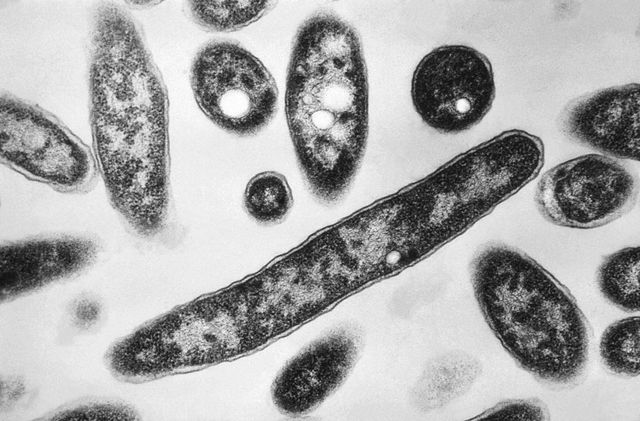 Legionella pneumophila bacteria, which causes the pneumonia condition known as Legionnaires’ disease.